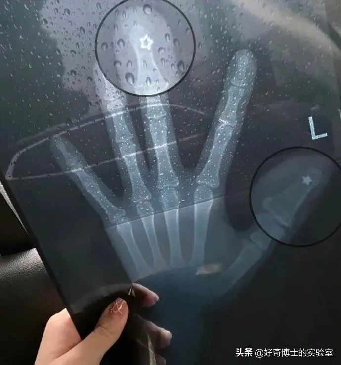 手机进水放米缸是什么原理,手机进水放进米缸有用吗