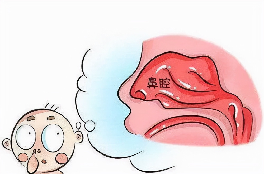 鼻炎为什么治不好,鼻炎到底该怎么治疗