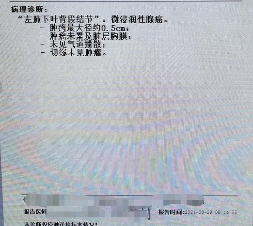 肺结节看诊（七）：这个肺结节手术太及时，空泡征小结节要注意