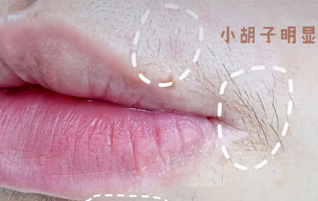 女性42岁早衰的危害,女性早衰的最佳治疗方法