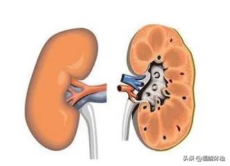 体检有肾囊肿需要注意什么,体检发现肾囊肿要怎么办