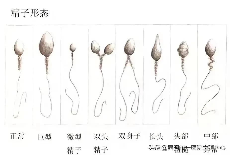「试管备孕」备孕三孩？男性同样也很重要