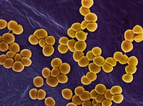 肺炎细菌感染用什么抗生素最好,新冠肺部感染后抗生素选择