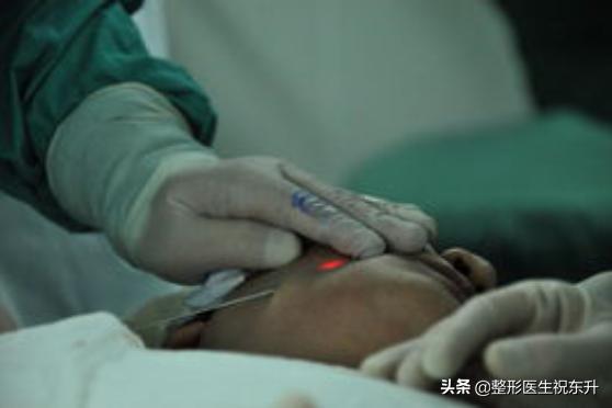 射频溶脂减肥手术具有三大并发症,做激光美容前需要注意什么