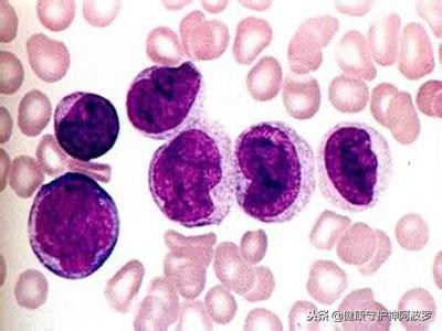 国产格列卫进入医保价格,格列卫是什么药价格表