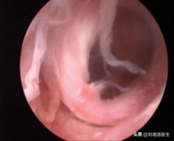 免疫不良妊娠可以通过中药治疗吗,免疫相关不良妊娠答疑解惑