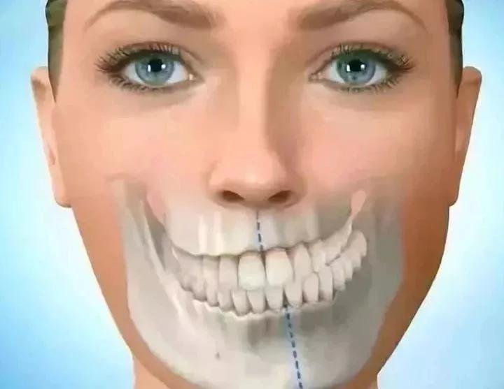 12岁孩子发育期需要注意哪些问题,12岁孩子高度近视矫正要多少钱