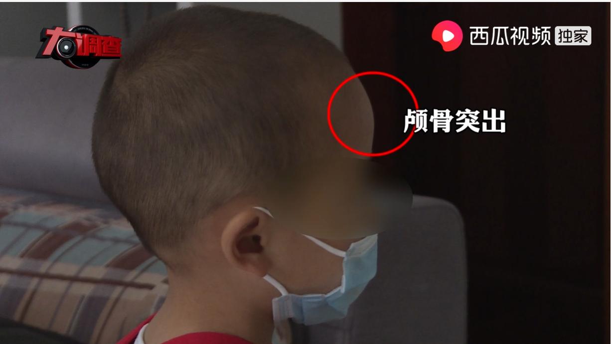 母婴店假奶粉出售,母婴店卖假奶粉吃出问题怎么处理