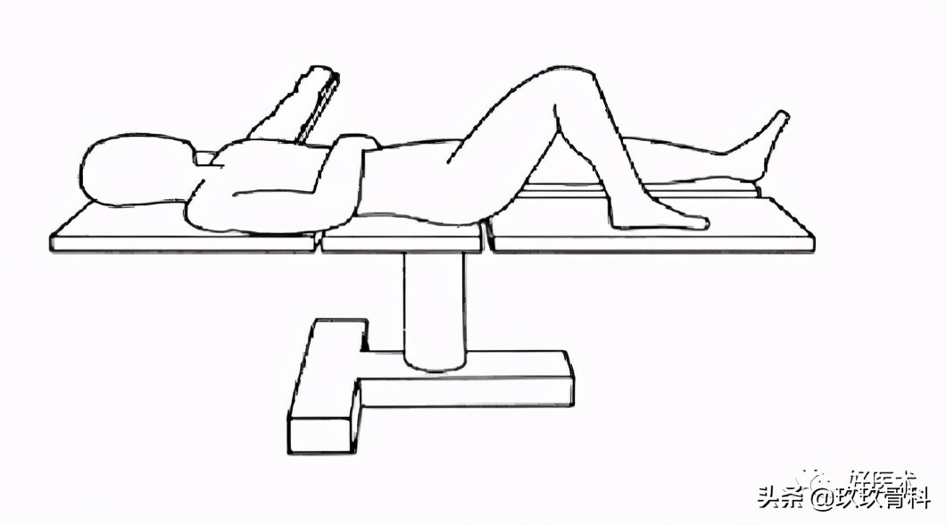 髓内钉技巧,髓内钉教学视频讲解