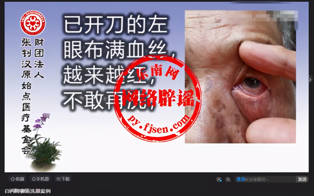 中医治白内障经典汤方,白内障用什么草药洗眼有效