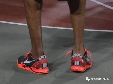 打篮球崴脚怎么处理热敷还是冷敷,崴脚超过48小时是热敷还是冷敷