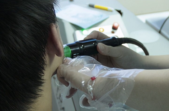 治疗白癜风到底是激光治疗好还是手术治疗好？