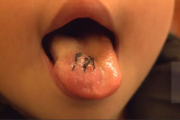 男童幼儿园内受伤,成都幼儿园摔伤幼儿事件