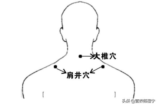 颈椎上的富贵包怎么减掉,颈椎富贵包怎么消除教你轻松一招