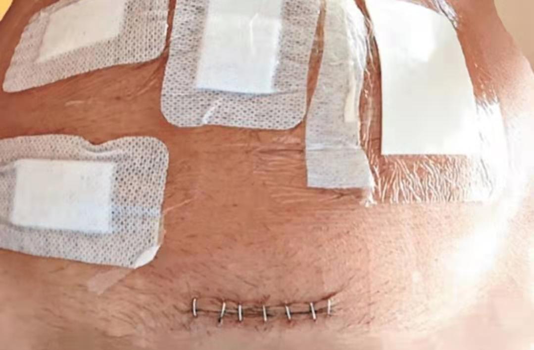 患直肠癌的明星,香港56岁男演员癌症去世