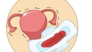 董氏奇穴治疗月经量少,温经汤治疗月经量少