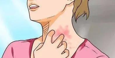 荨麻疹很痒忍下来有用吗,荨麻疹实在太痒了可以输液缓解嘛