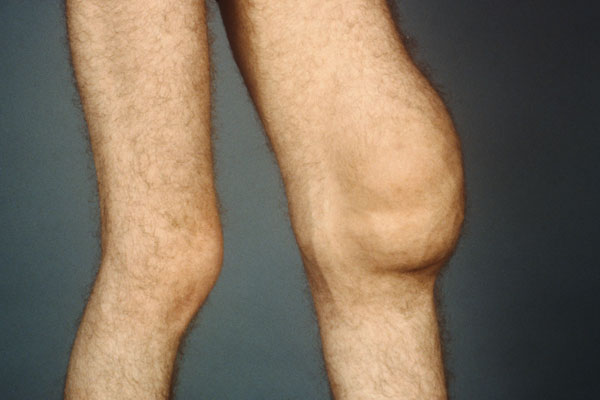 如何购买氨糖,氨糖购买