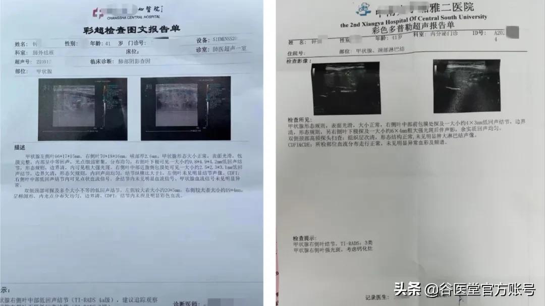 男子甲状腺结节，谷医堂耳鼻喉老中医庞忠红，42天治疗获奇效