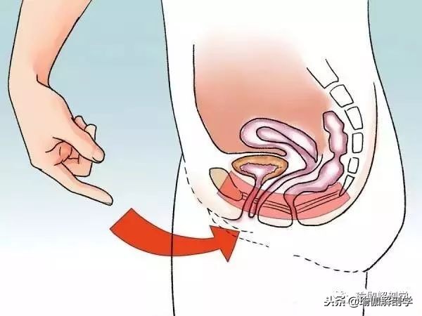 产后盆底肌修复和腹直肌修复区别 (产后修复盆底肌凯格尔运动30分钟)