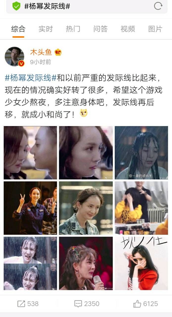 杨幂的高发际线,发际线秃的杨幂