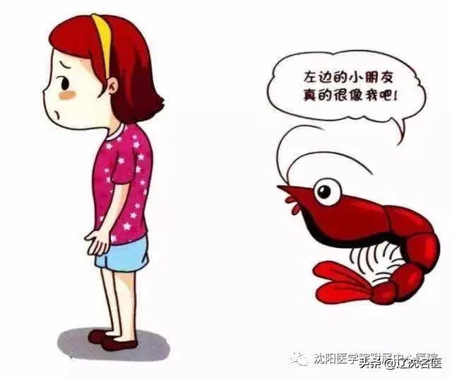 最好的儿童脊柱侧弯医院,简单辨别脊柱侧弯避免孩子走弯路