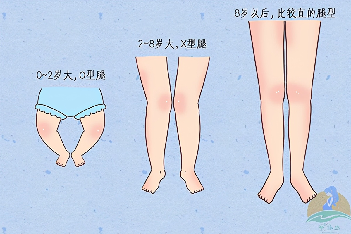 宝宝o型腿需要反穿鞋吗,宝宝出现o型腿应该怎么帮他按摩