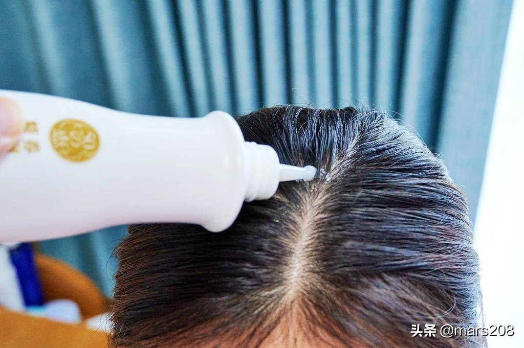 保护毛囊发际线的神器,防脱发保护发际线