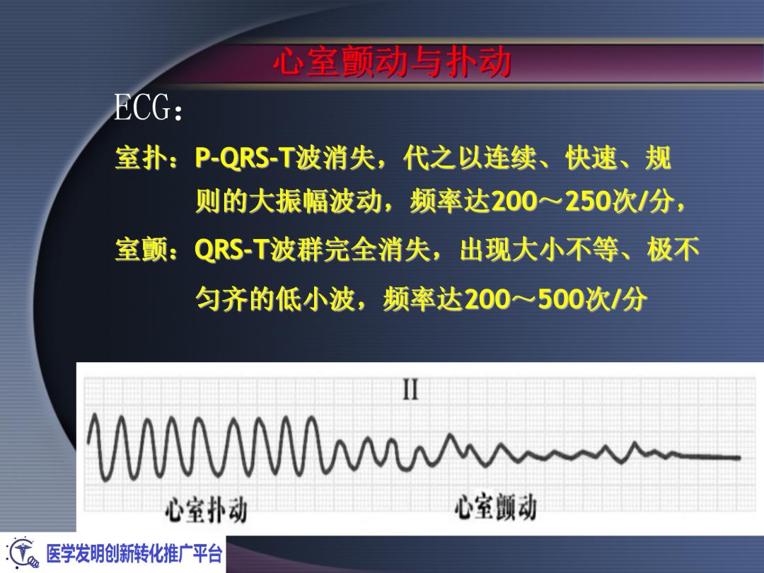 麻醉手术常见心律失常处理,麻醉引起心脏骤停原因