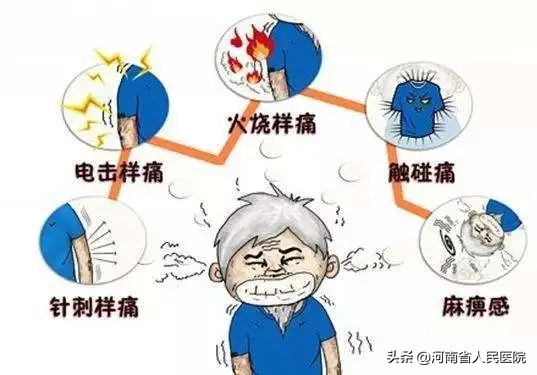 有一种疼痛,叫三叉神经痛