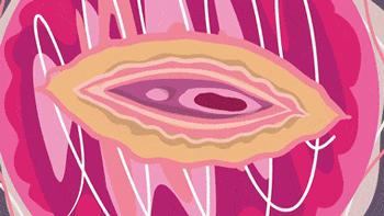 妇科炎症豆腐渣反反复复,孕期妇科炎症反反复复怎么办