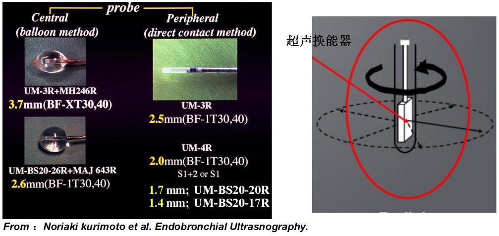 小细胞肺癌的气管镜介入治疗,导航支气管镜在肺癌诊断中的应用