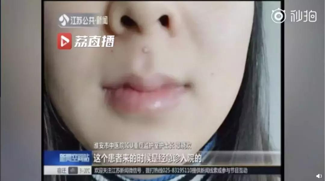 鎸ょ棙寰楅鍐呮劅鏌撶殑姒傜巼澶氬ぇ,鎸ょ棙鎰熸煋