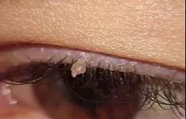 眼霜换着用会影响效果吗,眼霜涂了为什么还长细纹