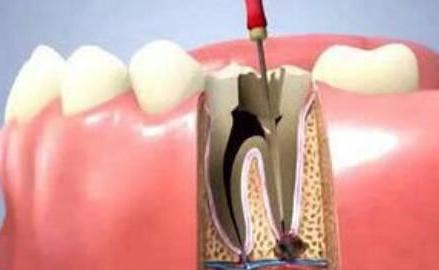 牙疼要命教你一招两分钟搞定牙疼,能够迅速缓解牙疼的9个小妙招