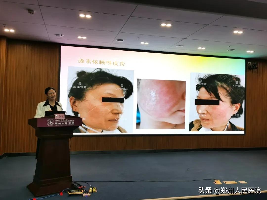 又一大咖入驻郑医啦！疑难少见皮肤病统统能搞定