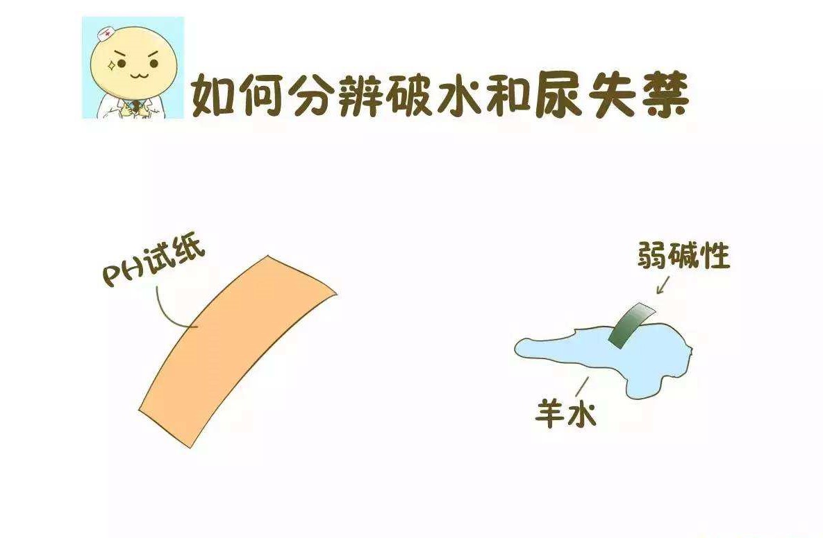 什么东西可以分清是破水还是漏尿,孕中期怎么分辨破水和分泌物