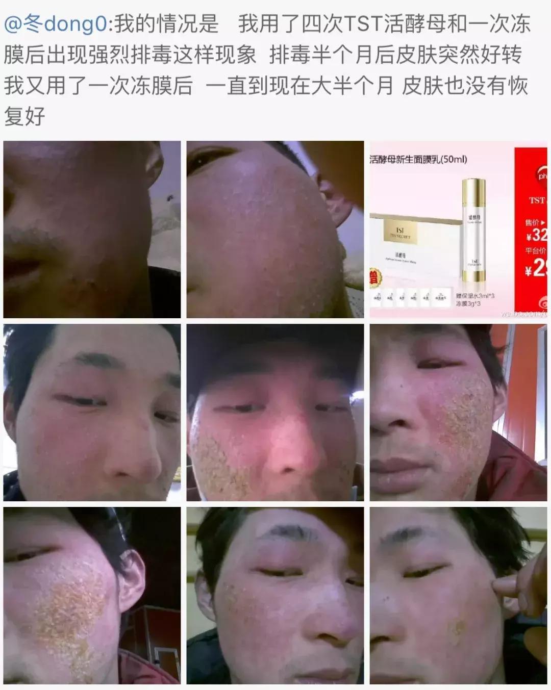 21亿智商税？屡遭质疑的微商面膜如此赚钱！林志玲陶虹都陷入了