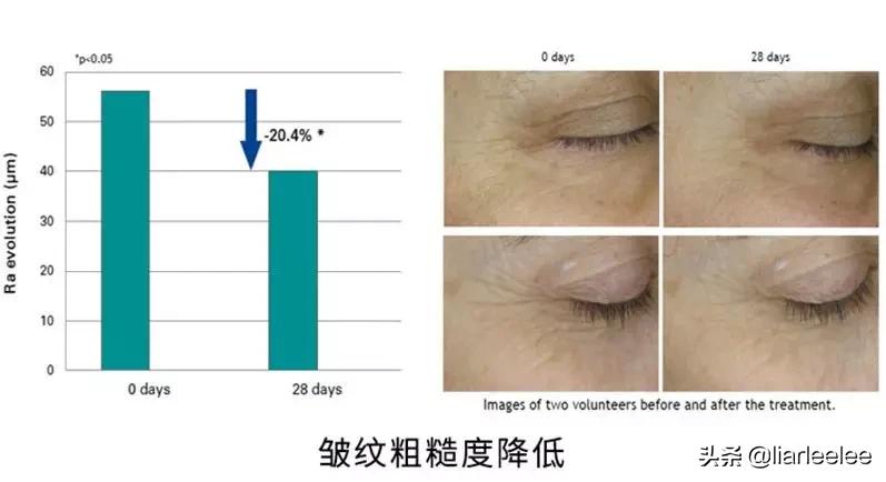 去细纹哪款眼霜值得入手百元内,又方便又好用的一款眼霜