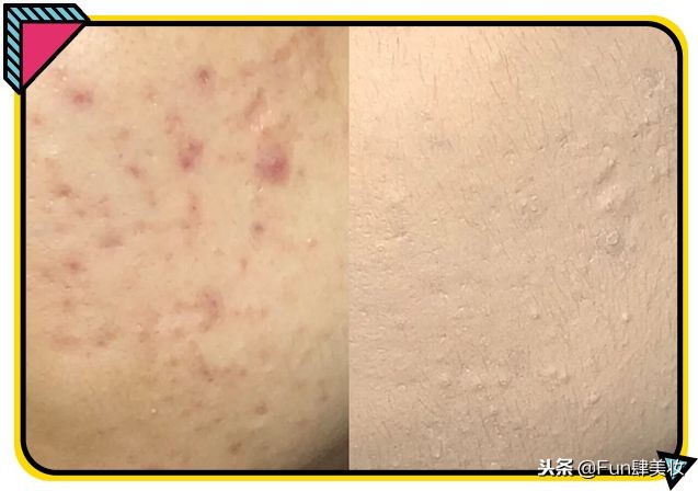 好用的粉底液推荐适合混合皮,超好用的粉底液提亮不脱妆