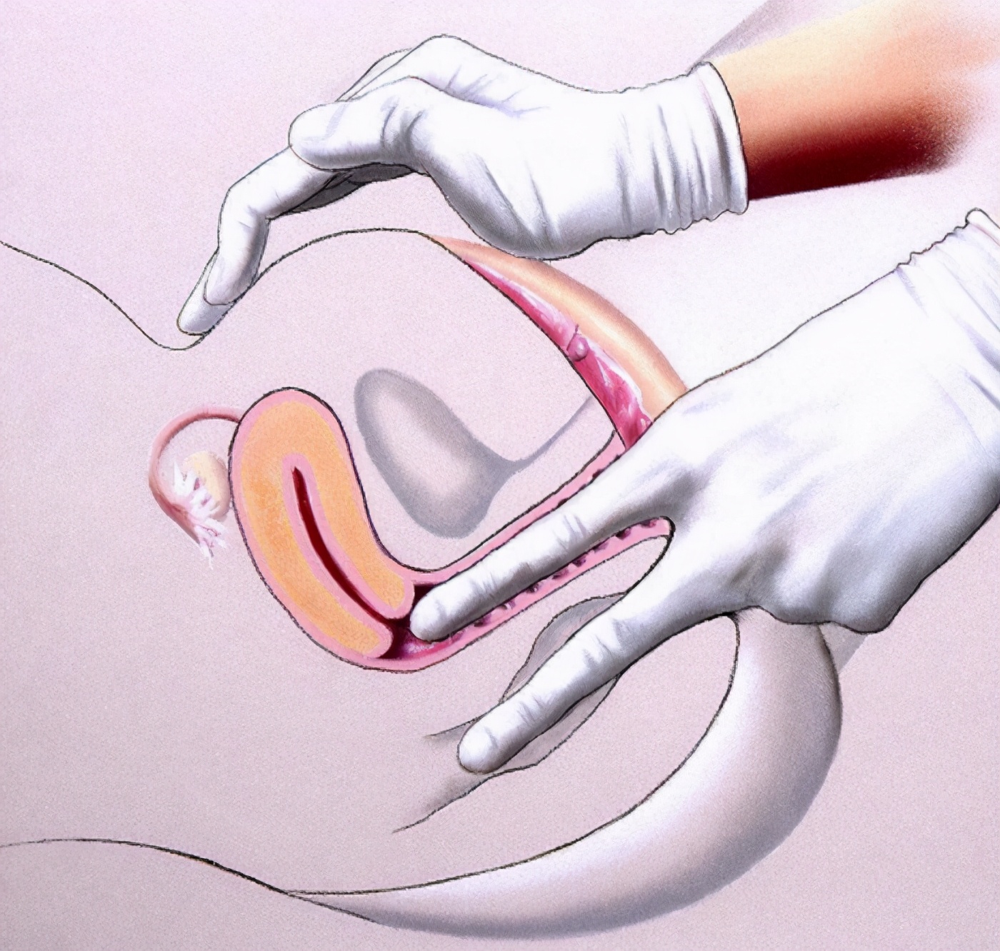 只有你才能真的保护好你自己，别耽误了检查