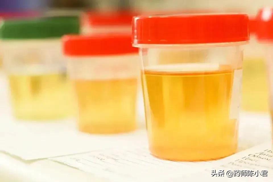 排尿很黄有酸味有痛,排尿很黄是不是排出毒素