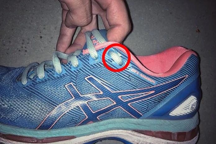 跑步跑出黑指甲怎么处理,跑步脚上出现黑趾甲该怎么处理