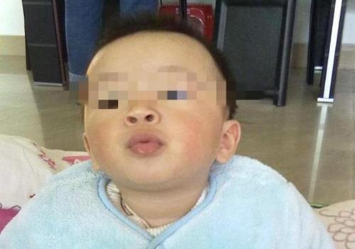 孩子总噘嘴导致牙床变形，竟是安抚奶嘴惹的祸，这个年龄就该戒了