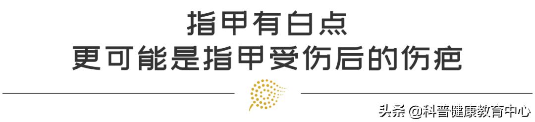 手相的科学解释,从医学角度解读手相的秘密