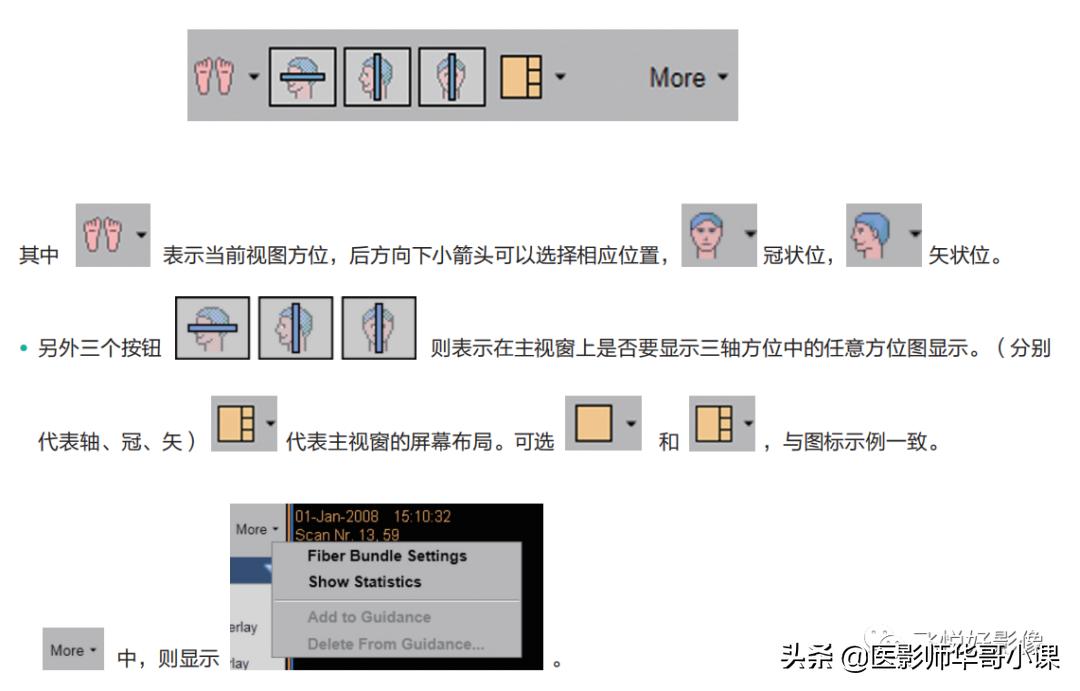 飞利浦磁共振波谱成像扫描技术,飞利浦磁共振纵隔扫描技术