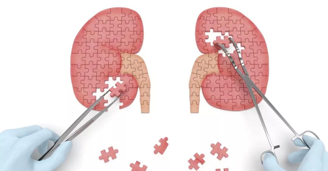 肾结石病人怎么补钙,补钙会导致肾结石吗