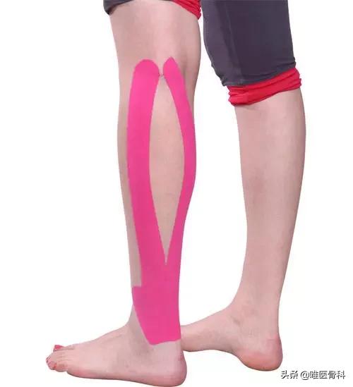 肌肉拉伤康复治疗最快最好方法,肌肉拉伤怎么做才能恢复更快