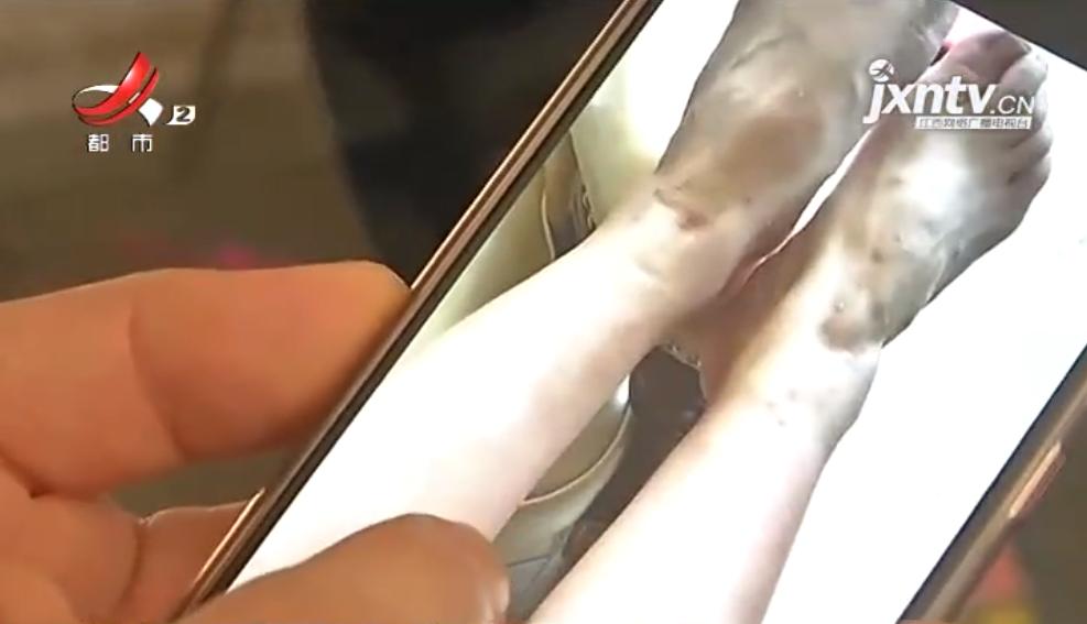 小区人身上痒,小区人身上奇痒无比