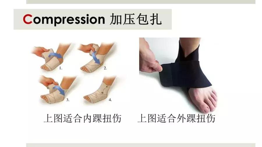 踝关节扭伤注意事项,踝关节扭伤的治疗原则